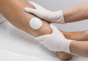 HydroThearpy dressing applied to patient by HCP