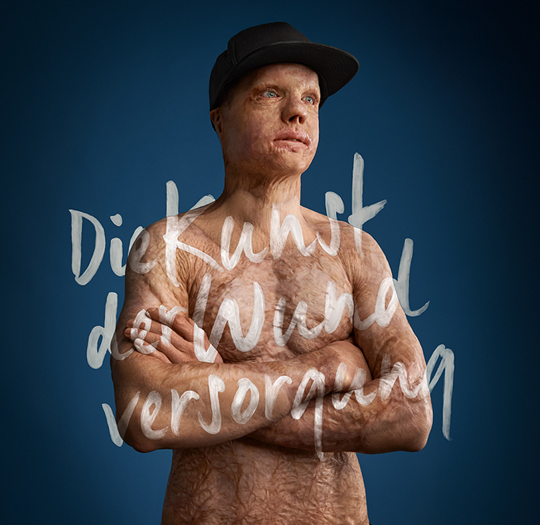 Philipp Bosshard as the ambassador for IFV HARTMANN’s wound symposium.