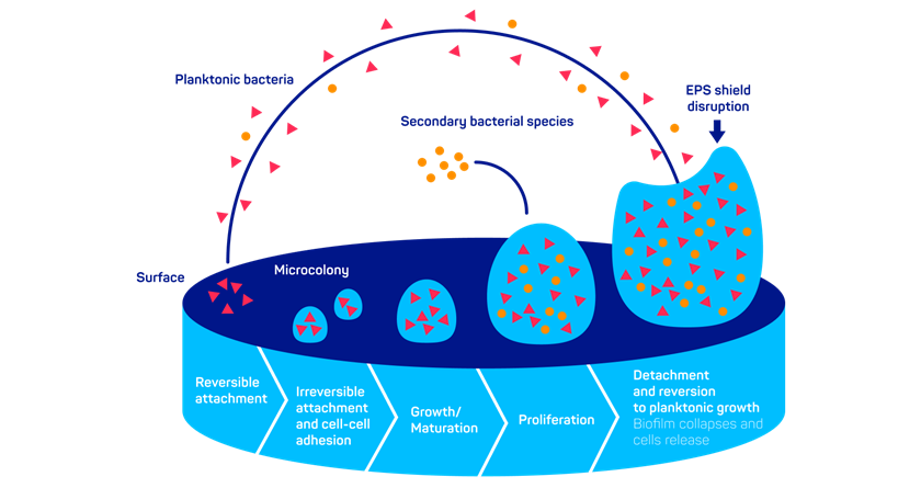 Cercla Cell PREVENTIA® Surgical irrigation