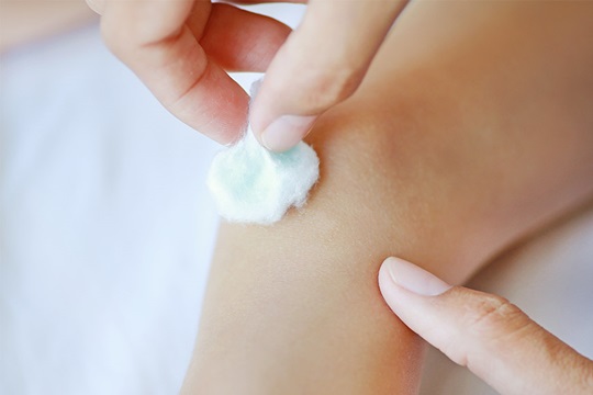 Frau reinigt eine Verletzung am Knie eines Kindes mit einem Wattebausch