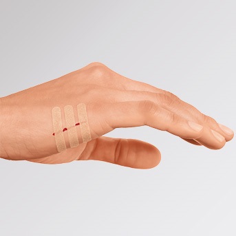 Dermaplast MEDICAL für Schnitt- und Platzwunden