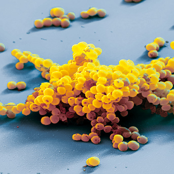 MRSA-Abbildung – Gesundheitsrisiko am Arbeitsplatz: MRSA 