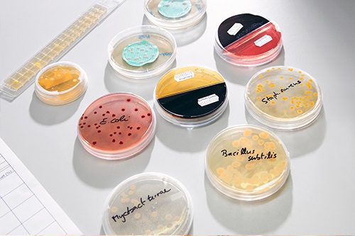 enfermedades infecciosas