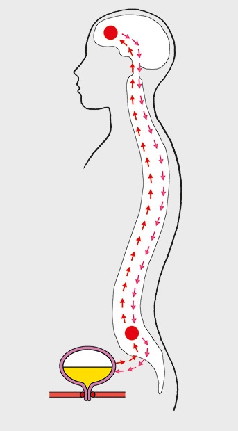 Störung bei der Blasenentleerung