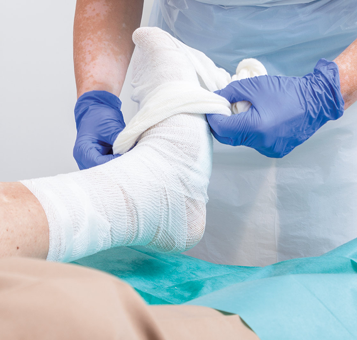 Anlegen eines Stuelpverbandes am rechten Fuß mit Einmalhandschuhen