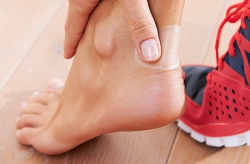 vesciche ai piedi