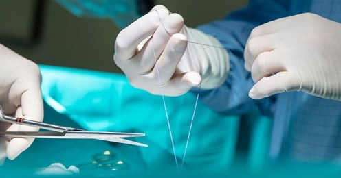 Szycie rany - kiedy jest konieczne, jak wygląda i jak się goi - HARTMANN Polska