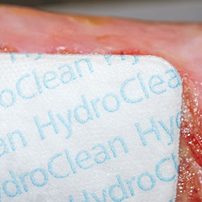 HydroClean Abbildung am Fuß