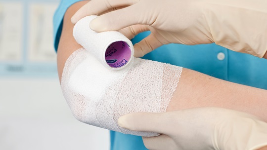 Fixierung von Wundauflage am Arm mit einer Fixierbinde