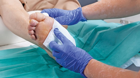Wundversorgung einer Wunde am Fuss
