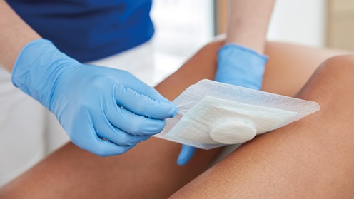Anlegen einer Wundauflage am Unterschenkel