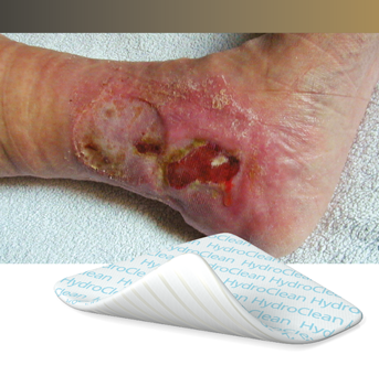 Feuchtigkeitsoptimierung mit HydroClean