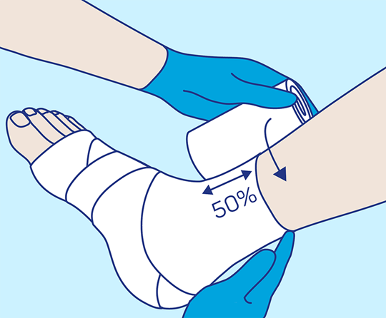 PütterPro 2 Anlegetechnik Schritt 3