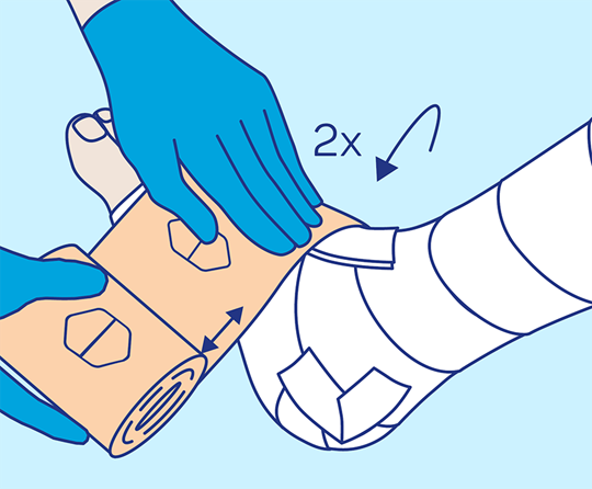 PütterPro 2 Anlegetechnik Schritt 5