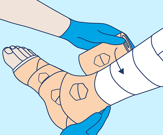 PütterPro 2 Anlegetechnik Schritt 6