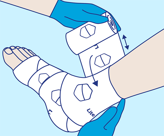 PütterPro 2 Lite Anlegetechnik Schritt 3