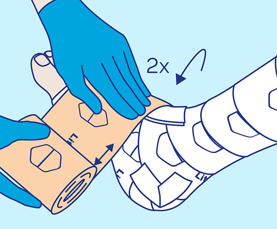 PütterPro 2 Lite Anlegetechnik Schritt 5