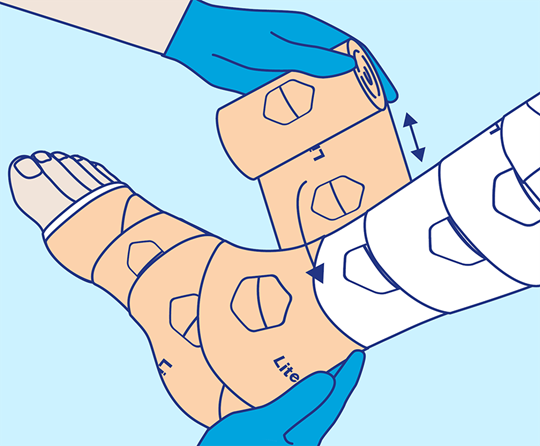 PütterPro 2 Lite Anlegetechnik Schritt 6