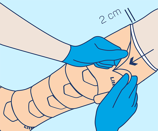 PütterPro 2 Lite Anlegetechnik Schritt 7