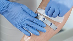 Anwendung von Hydrotac am Unterschenkel | PHI24_01