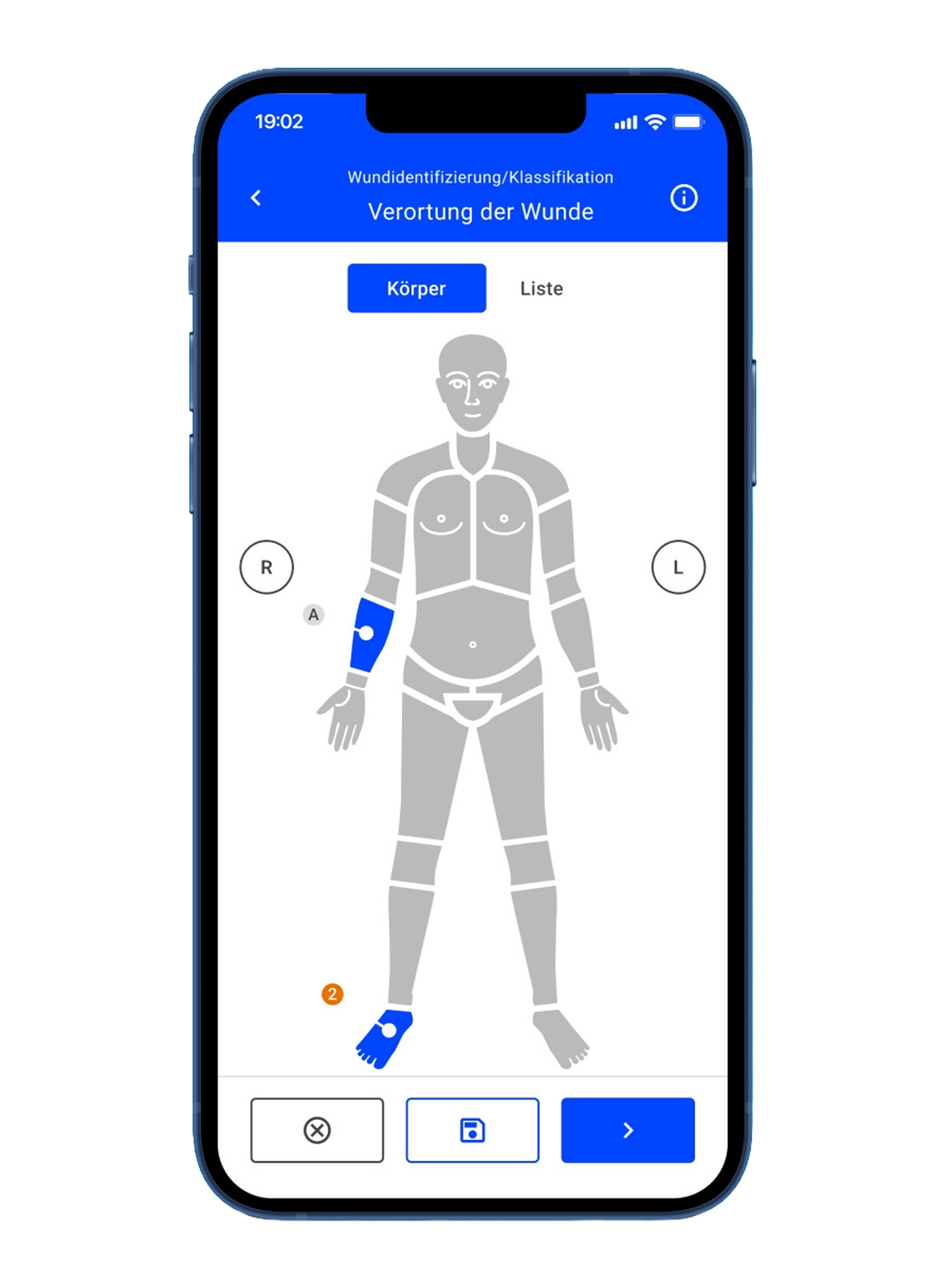Wunddokumentation mit Hilfe der Easy App auf einem Mobiltelefon