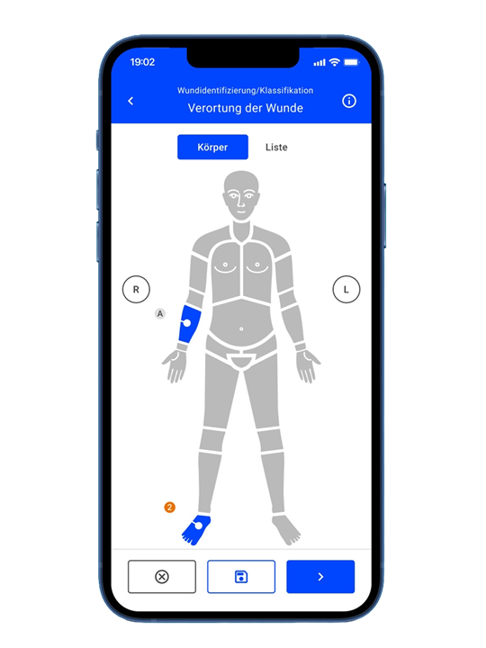 Wunddokumentation mit Hilfe der Easy App auf einem Mobiltelefon