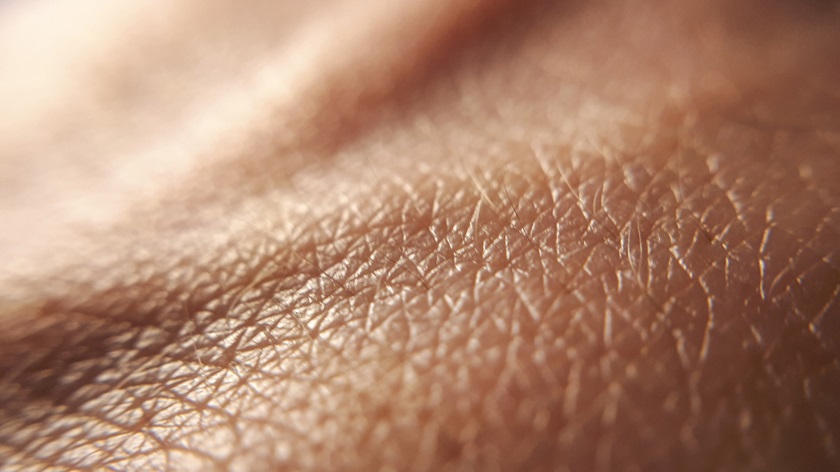 A close up picture of skin