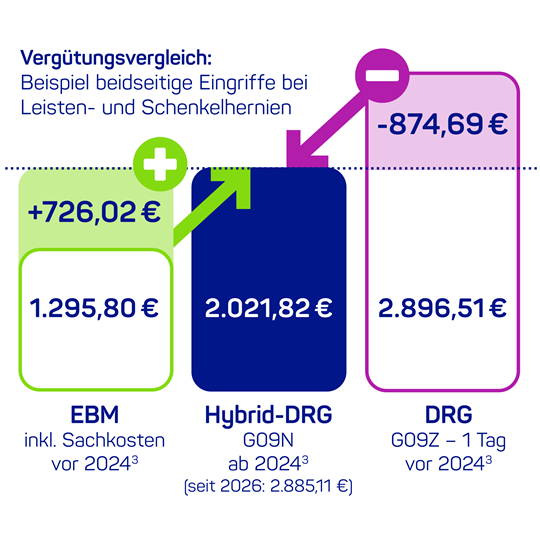 Grafik mit 3 Balken. Vergütungsvergleich für beidseitige Eingriffe bei Leisten- und Schenkelhernien. Links EBM-Vergütung inkl. Sachkosten = 1.295,80 € plus zusätzlich 726,02 €. Rechts DRG-Vergütung bei G09Z 1 Tag = 2.896,51 € minus 874,69 €. Mitte Hybrid-DRG bei G09N = 2.021,82 €