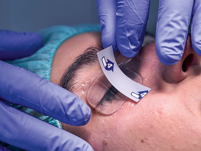 HydroTac® Transparent : Anlegen über den Augen einer Patientin vor einer OP