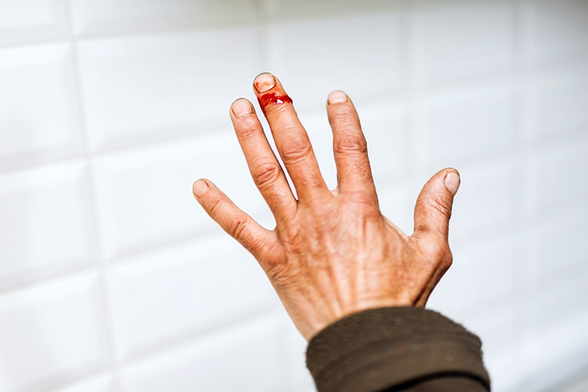 Skaleczenie palca | DermaPlast