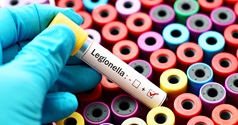 Legionella - bakteria wywołująca legionellozę - HARTMANN Polska