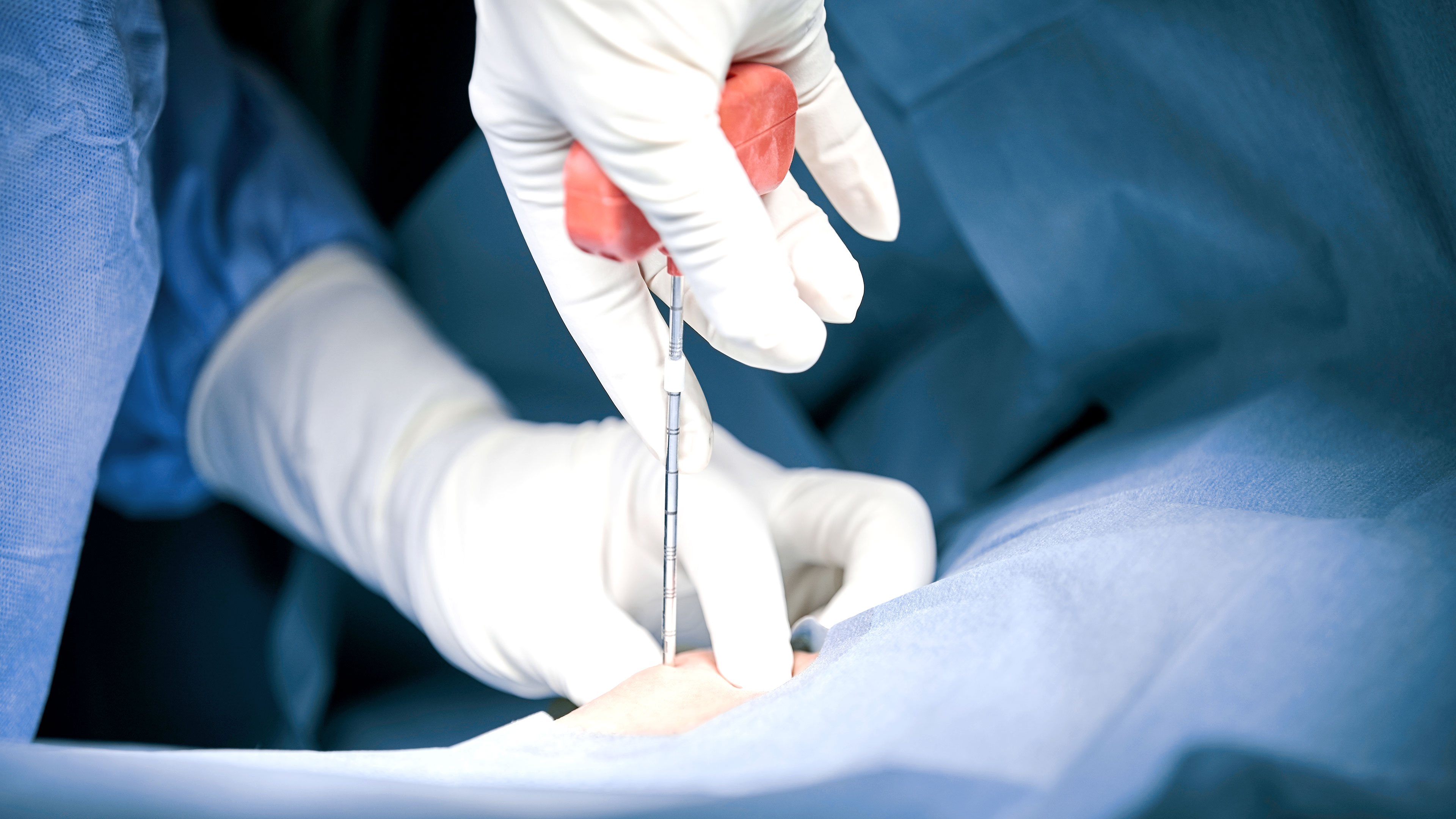 Close-up of a surgical procedur