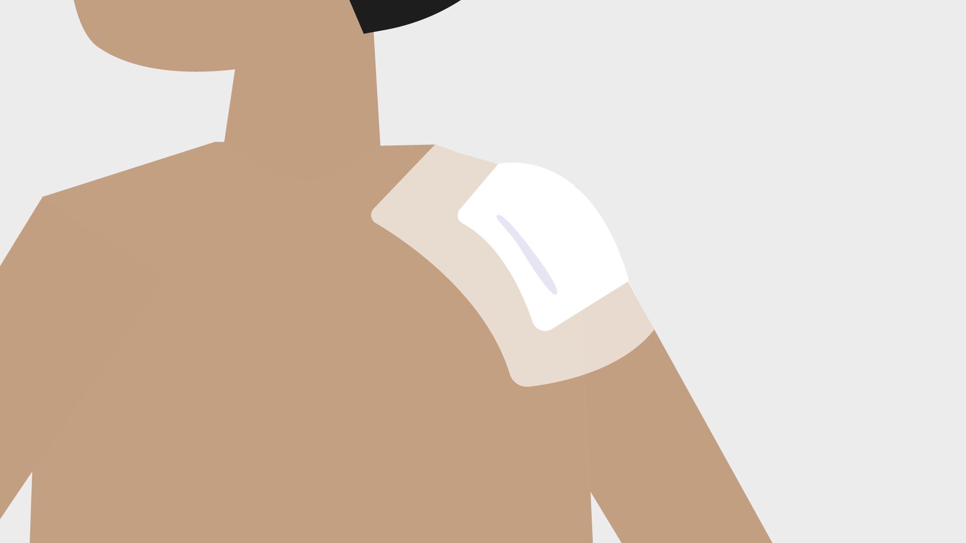 Illustration of a shoulder with surgery wound covered for protection.
